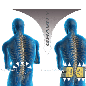 baxmax-xray BaxMax Lumbar Support