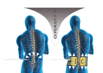 baxmax-xray BaxMax Lumbar Support