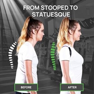 posturemedic-before-after Posture Medic